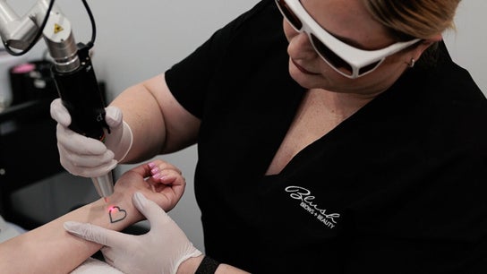 Laser Tattoo Removal Mackay