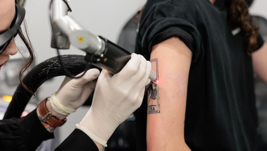 Tattoo removal procedure at Tattoo Removal Mackay, North Mackay, Queensland, AU with laser equipment.
