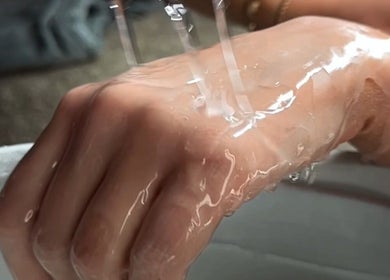Hand rejuvenation treatment at Perfect Beauty Setubal, Setúbal, PT, showcasing skin hydration.