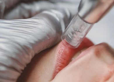 Lip treatment in progress at Perfect Beauty Setubal, Setúbal, Setúbal, PT showcasing expert care.