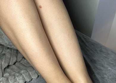Smooth legs post-treatment at Perfect Beauty Setubal, Setúbal, Setúbal, PT. Luxurious spa experience.