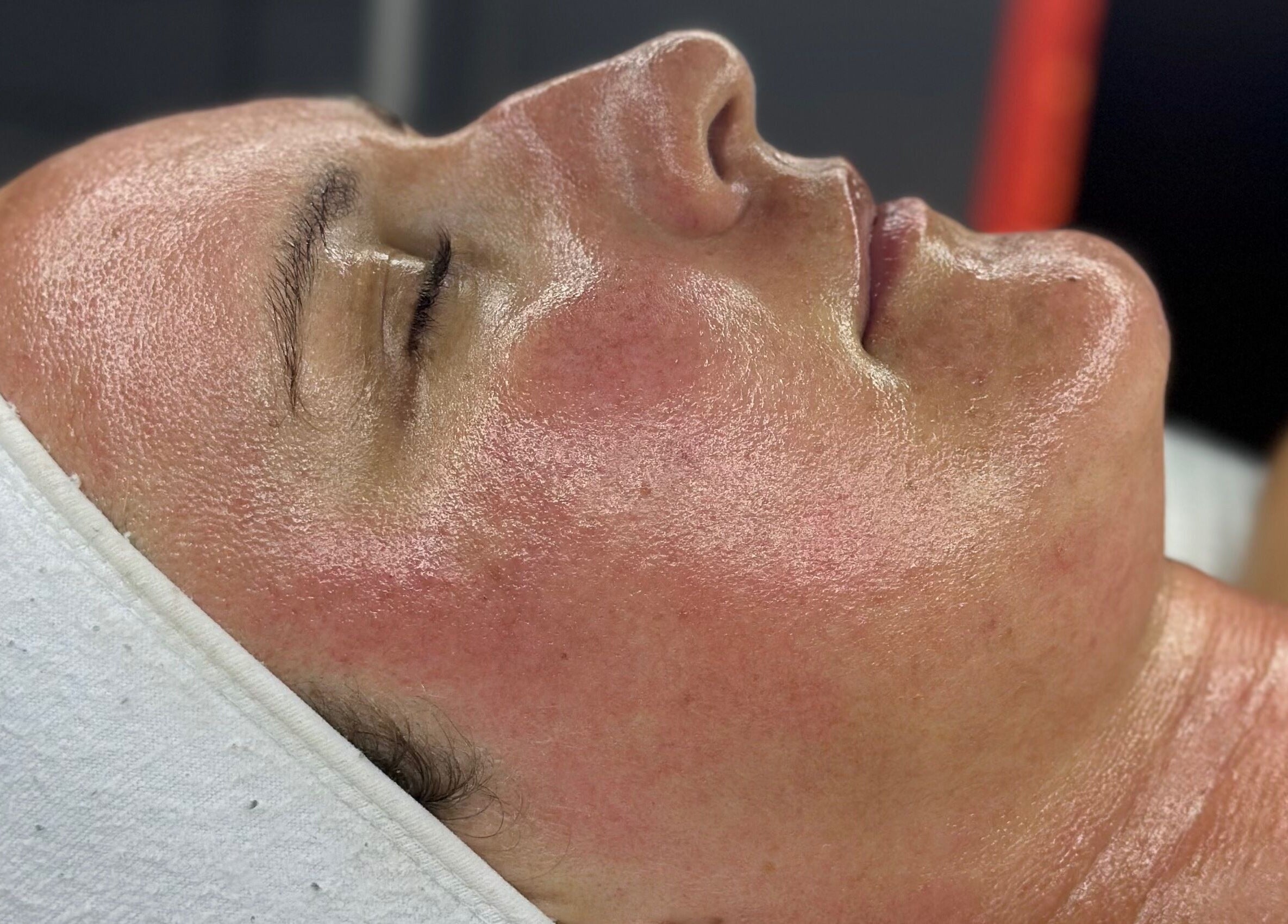 Radiant facial treatment at BBH SKIN in Brent Pelham, England, GB showcasing glowing, smooth skin.