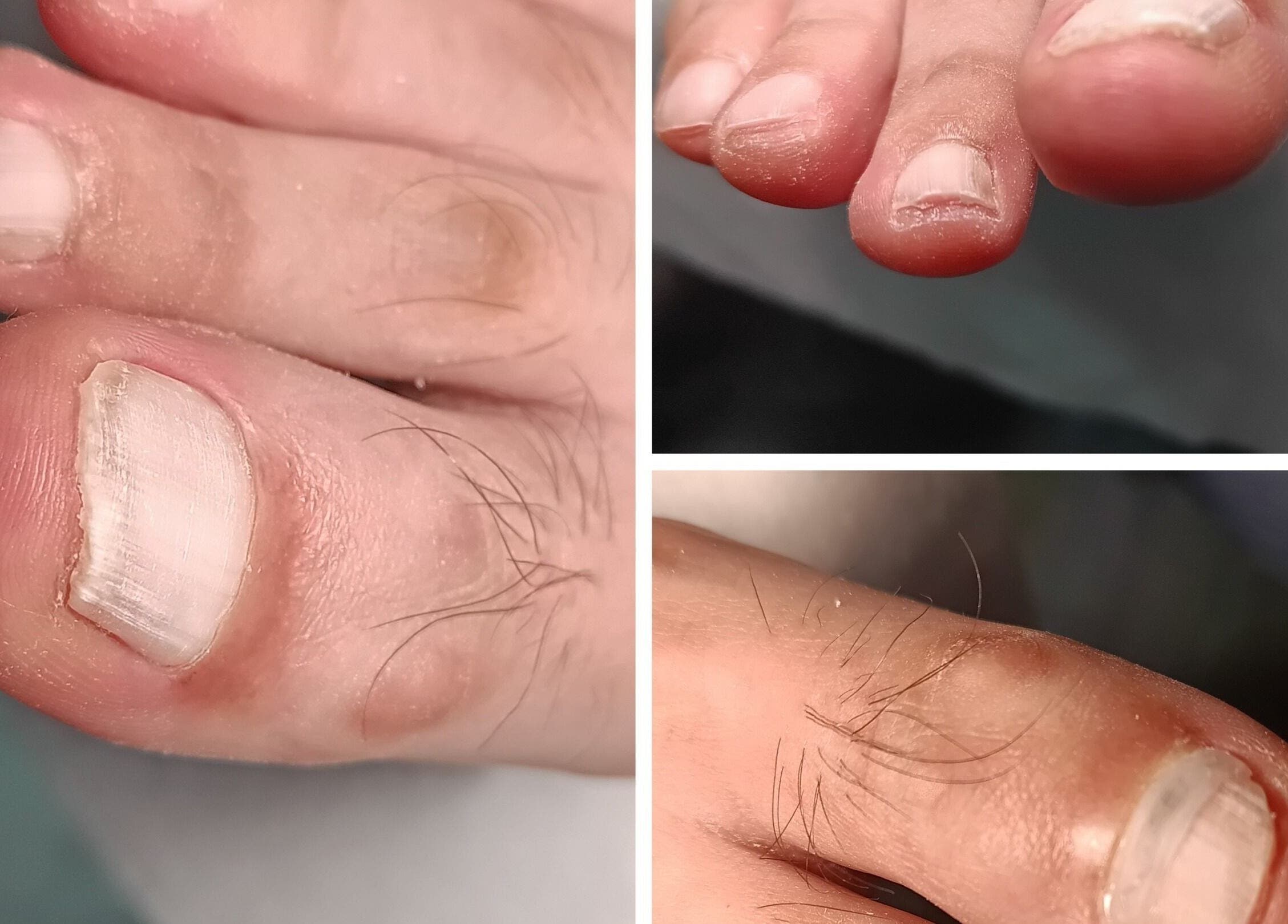 Близък план на педикюр в Algara beauty studio, Шумен, Област Шумен, BG.