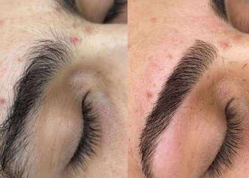 Before and after eyebrow transformation at Twinz Beauty (Ladies only), Tamworth, England, GB.