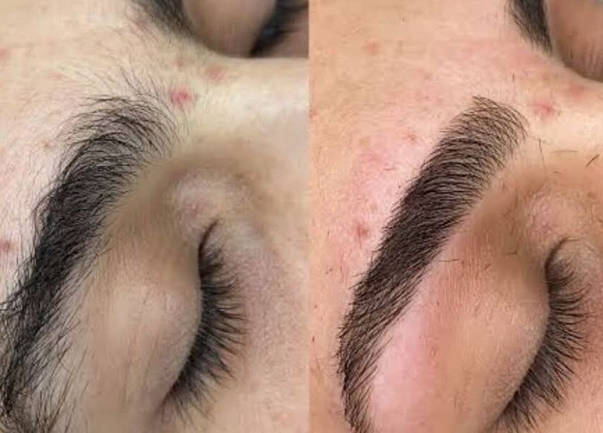 Before and after eyebrow transformation at Twinz Beauty (Ladies only), Tamworth, England, GB.
