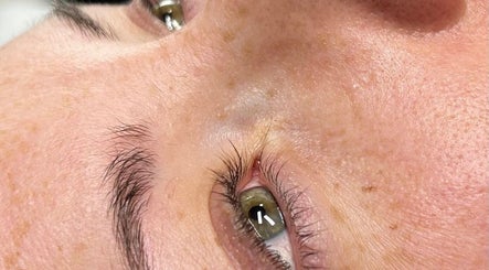 Close-up of an eye with fresh treatment at Skinfinity, Waterlooville, England, GB for rejuvenated skin.