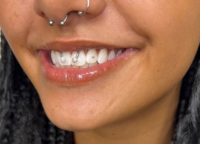 Radiant smile with dental gems at Laterals and Lashes, Coventry, England, GB.