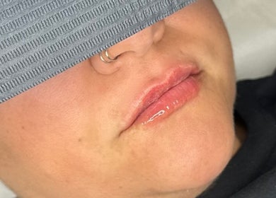 Close-up of glossy lips after treatment at Opulent Aesthetics & Beauty, Stevenage, England, GB.