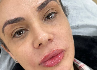 Close-up of glossy lips after treatment at Opulent Aesthetics & Beauty, Stevenage, England, GB.