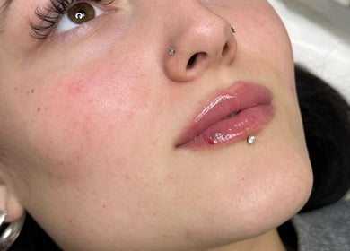Close-up of glossy lips after beauty treatment at Opulent Aesthetics & Beauty, Stevenage, England, GB.