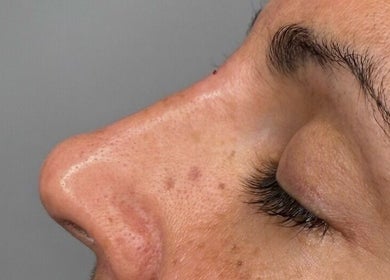 Close-up of serene skin care result at The Glow House, Hutton Rudby, England, GB.