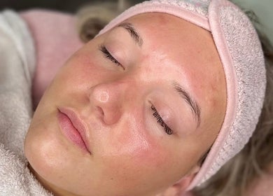 Relaxed face with glowing skin at The Glow House, Hutton Rudby, England, GB in a beauty treatment.