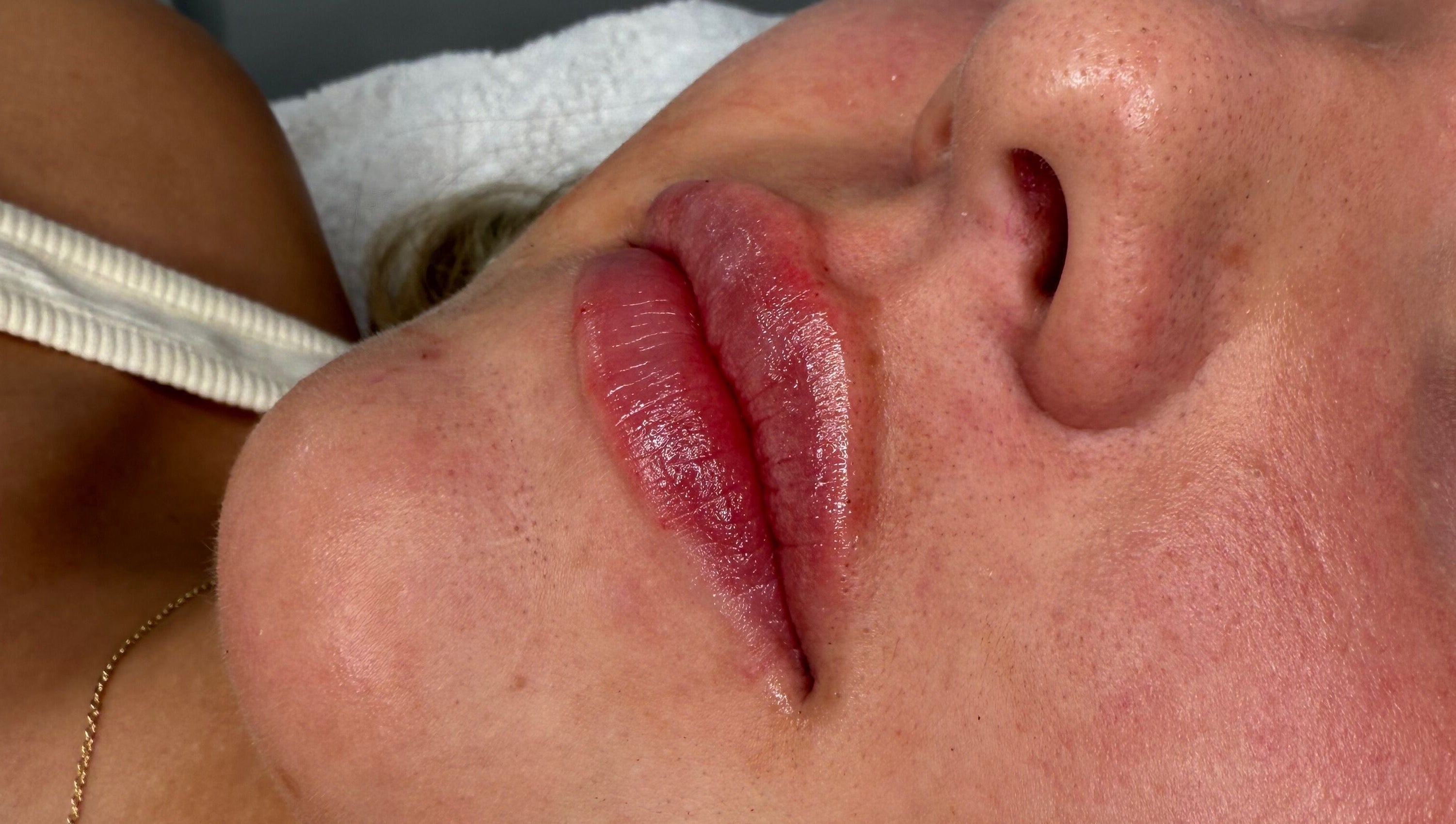 Close-up of enhanced lips at The Glow House, Hutton Rudby, England, GB, showcasing expert beauty treatments.