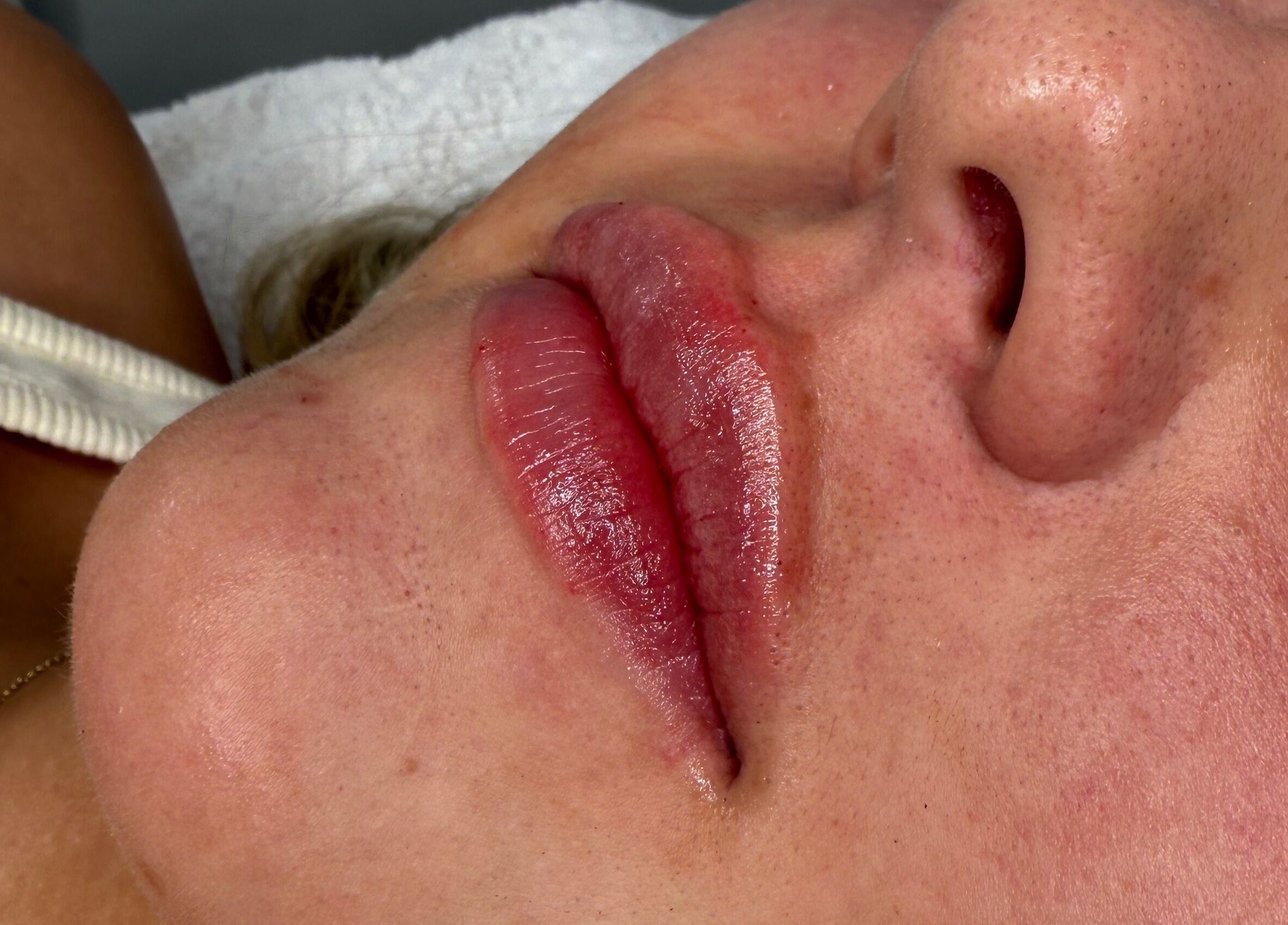 Close-up of enhanced lips at The Glow House, Hutton Rudby, England, GB, showcasing expert beauty treatments.