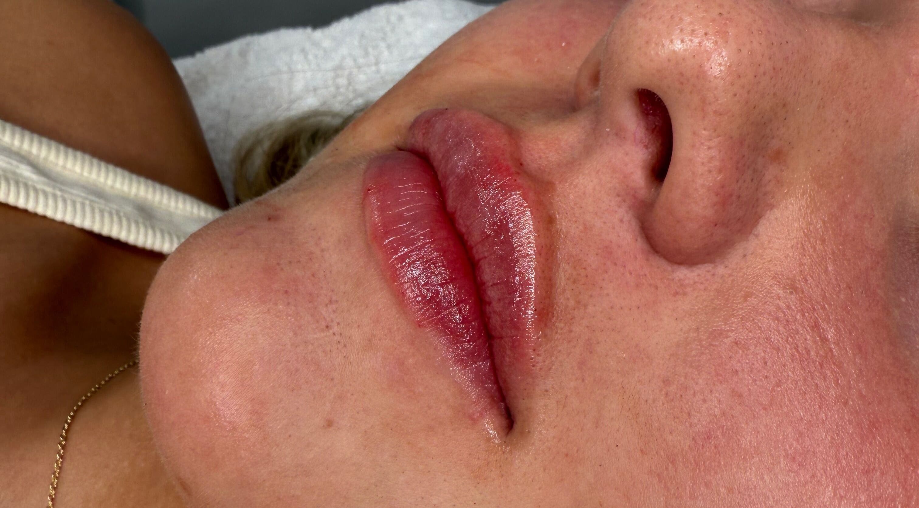 Close-up of enhanced lips at The Glow House, Hutton Rudby, England, GB, showcasing expert beauty treatments.