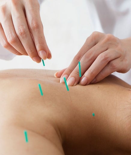 421 Li Wellness Acupuncture image 2