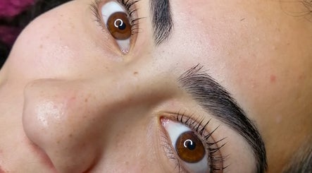 Vuela alto lifting y cejas – kuva 2