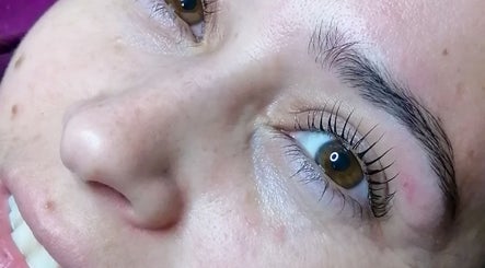 Vuela alto lifting y cejas – kuva 3