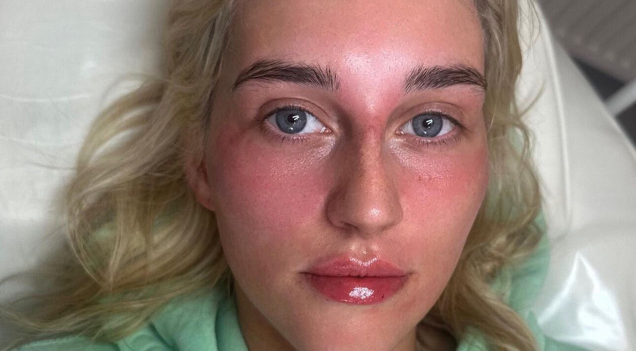 Radiant complexion after facial at Sculpt Aesthetics, Sunderland, England, GB. Fresh and rejuvenated skin.