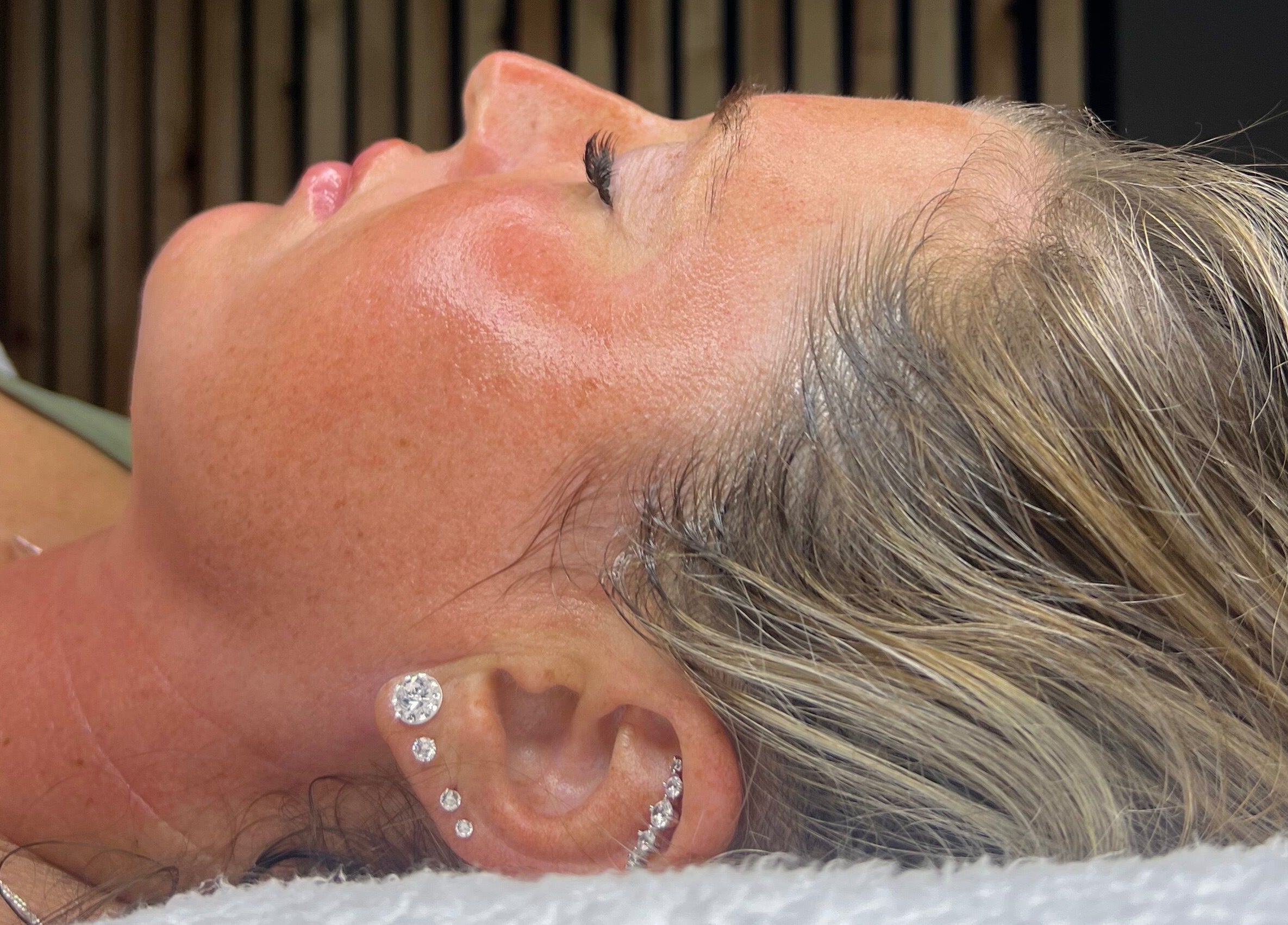 Relaxing facial treatment at The Skin Studio, Skegness, England, GB, highlighting rejuvenated, glowing skin.