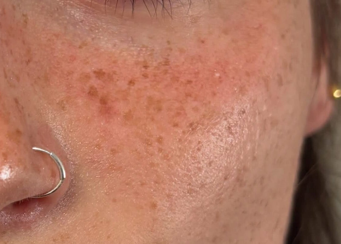 Close-up of youthful, radiant skin at Lashes By Yas X in Ashbourne, England, GB, showcasing freckles and natural beauty.