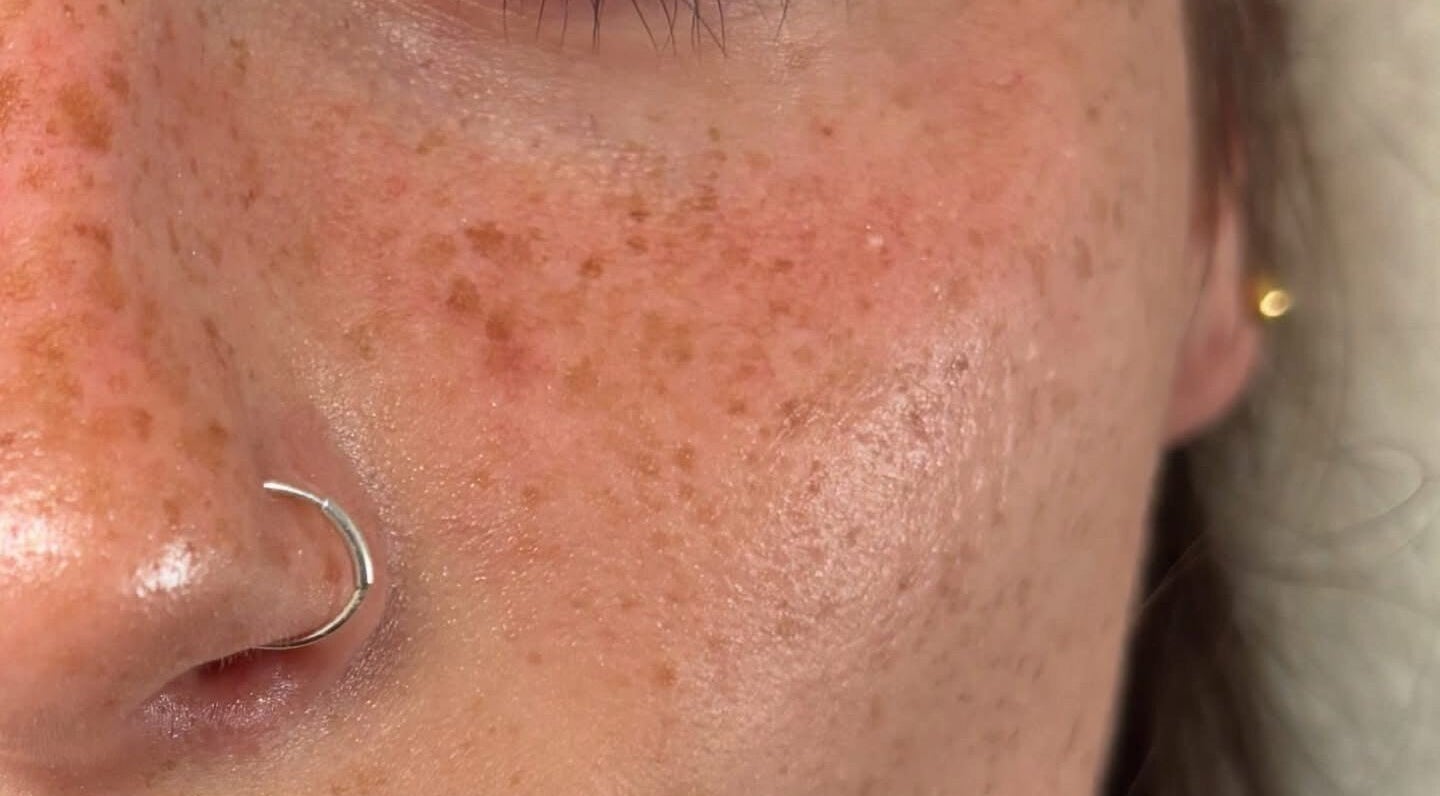 Close-up of youthful, radiant skin at Lashes By Yas X in Ashbourne, England, GB, showcasing freckles and natural beauty.