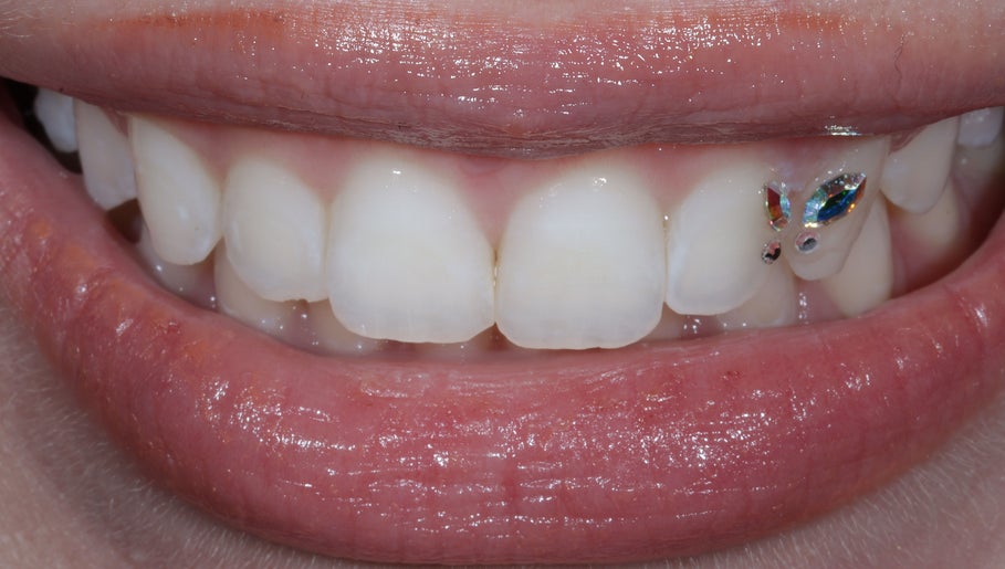 sydneytoothglam image 1