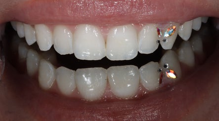 sydneytoothglam image 2