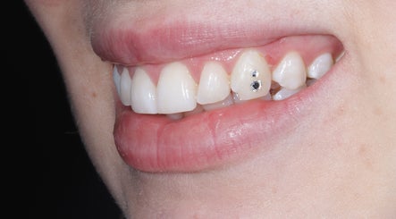 sydneytoothglam image 3