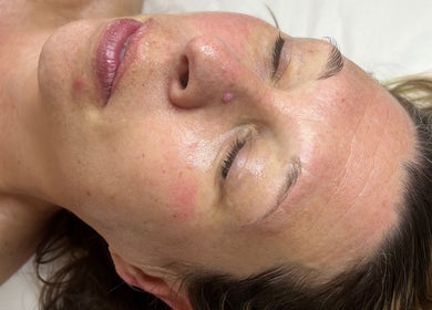 Facial treatment at The Glow Collective, Lichfield, England, GB for skin rejuvenation.