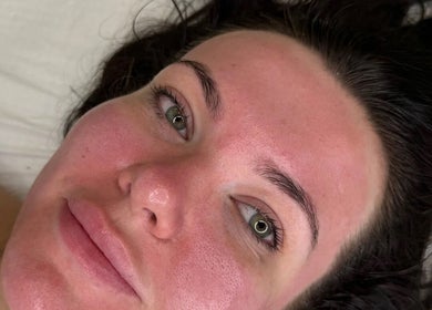 Facial treatment at The Glow Collective, Lichfield, England, GB, showcasing refreshed skin with a natural glow.
