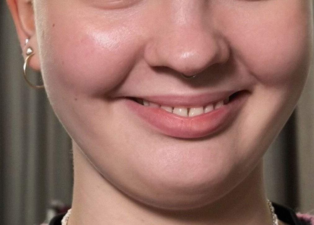 Detailní pohled na úsměv zákaznice v Noéme, Jihomoravský Kraj, CZ.