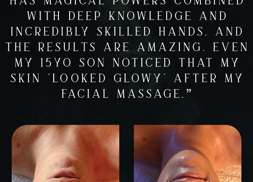 Review of Star Seed + Violet Stopford Retreat Popup facial results in London, England, GB showing skin improvement.