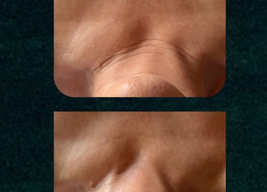 Close-up of smooth forehead after beauty treatment at Star Seed + Violet Stopford Retreat Popup, London, England, GB.
