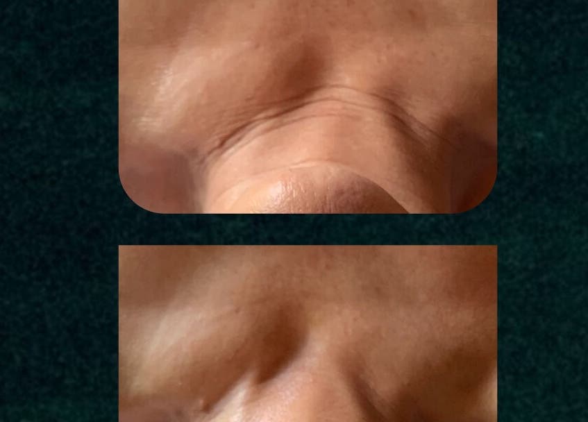Close-up of smooth forehead after beauty treatment at Star Seed + Violet Stopford Retreat Popup, London, England, GB.