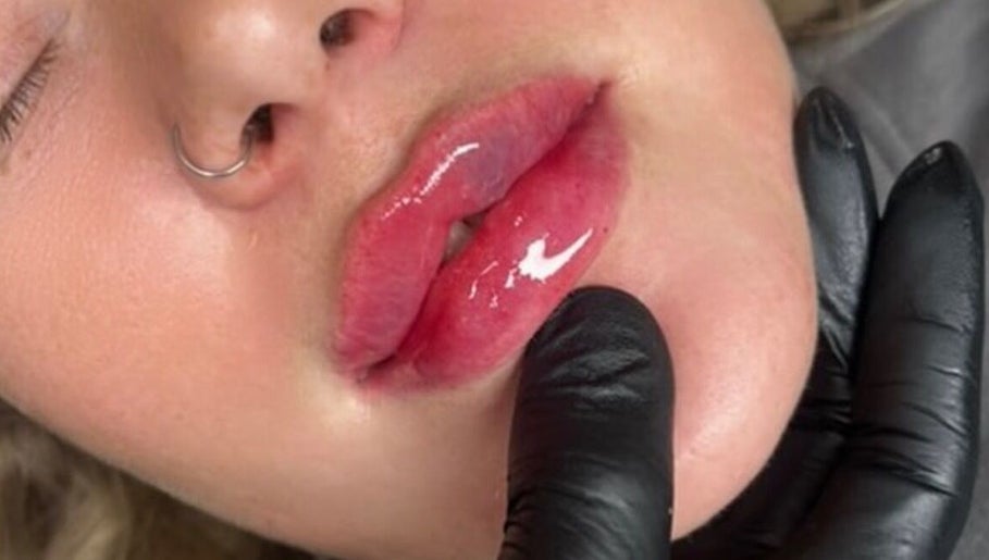 Glossy lip enhancement at Daniella Marie Beauty & Aesthetics, Derby, England, GB.