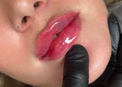 Glossy lip enhancement at Daniella Marie Beauty & Aesthetics, Derby, England, GB.