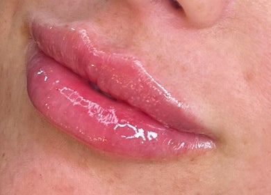 Glossy lips treatment at Daniella Marie Beauty & Aesthetics, Derby, England, GB.