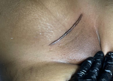 Skin treatment at HONEYBODY BEAUTY BAR & THE LOC HIVE, May Pen, Clarendon, JM, shown with professional gloved hands.
