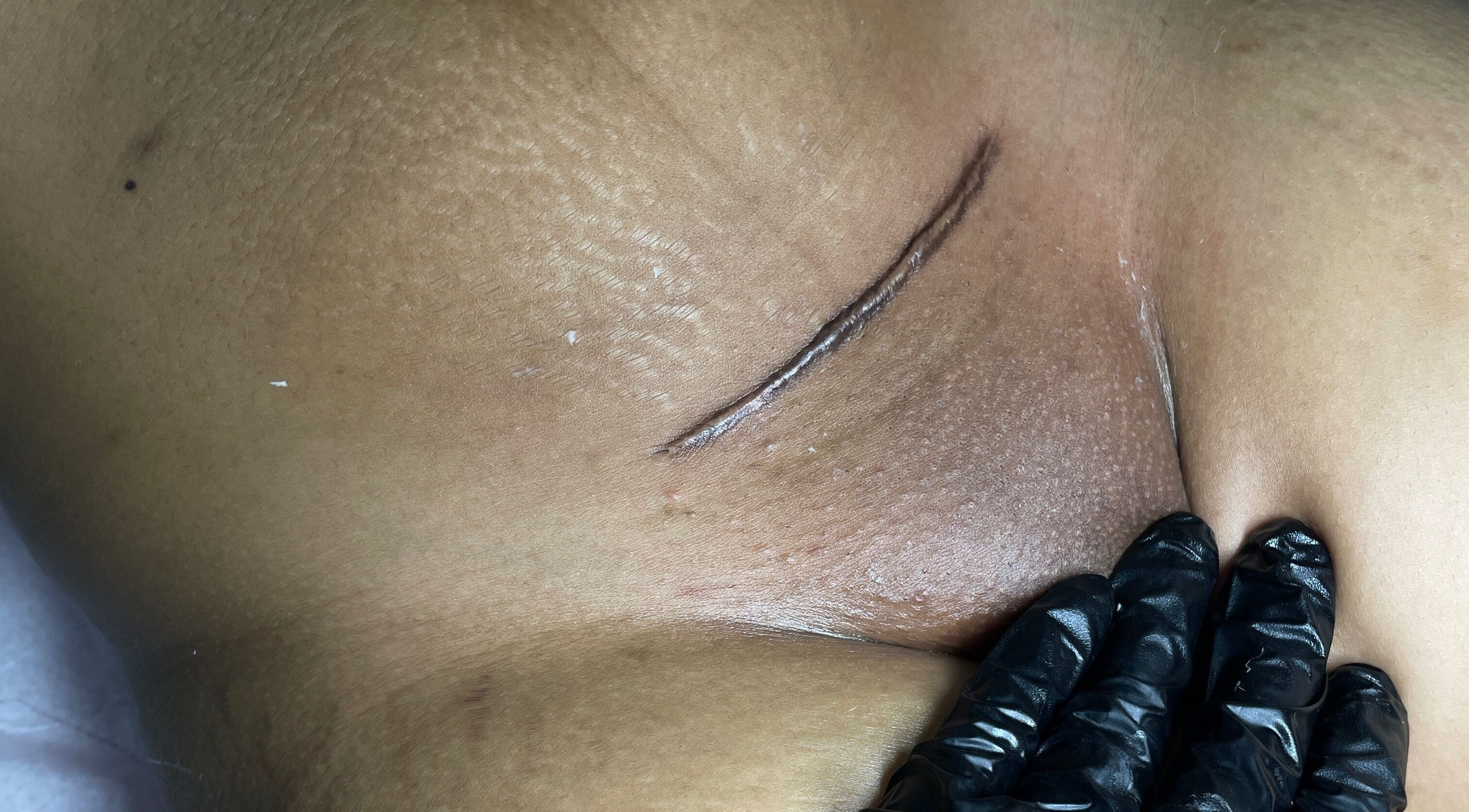 Skin treatment at HONEYBODY BEAUTY BAR & THE LOC HIVE, May Pen, Clarendon, JM, shown with professional gloved hands.