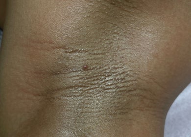 Close-up skin detail from HONEYBODY BEAUTY BAR & THE LOC HIVE, May Pen, Clarendon, JM for beauty services.