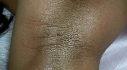 Close-up skin detail from HONEYBODY BEAUTY BAR & THE LOC HIVE, May Pen, Clarendon, JM for beauty services.