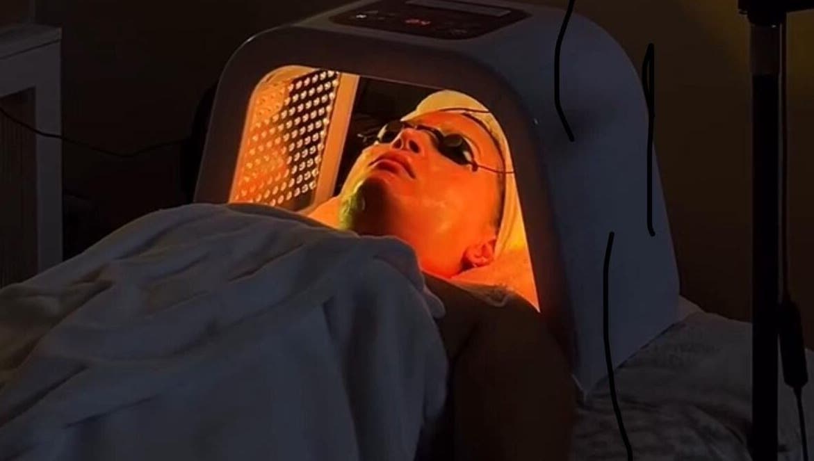 Tratamiento de luz LED en Venus Beauty Clinic, Cabo San Lucas, Baja California Sur, MX.