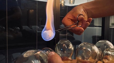 A.J.Healing in South Ockendon, England uses traditional cupping set up with a flame for holistic therapy.