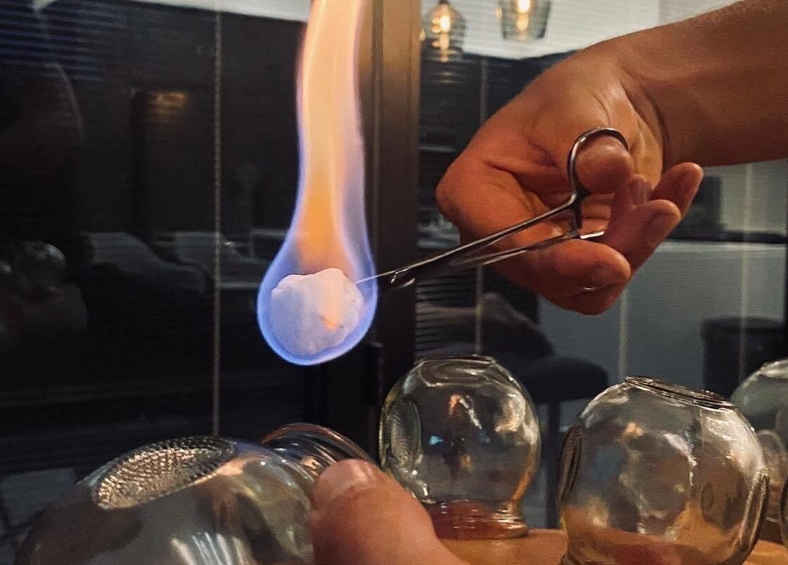 Cupping therapy setup with flame at A.J.Healing, South Ockendon, England, GB. Enhances wellness and relaxation.