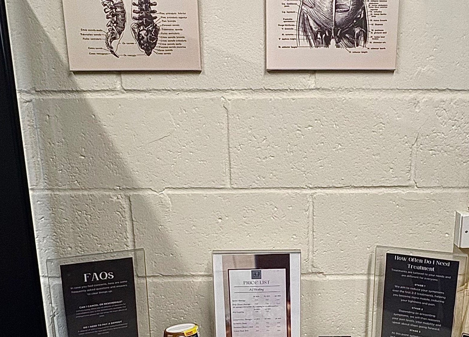 A.J.Healing wellness information display in South Ockendon, England, GB, showcasing informative anatomy charts.