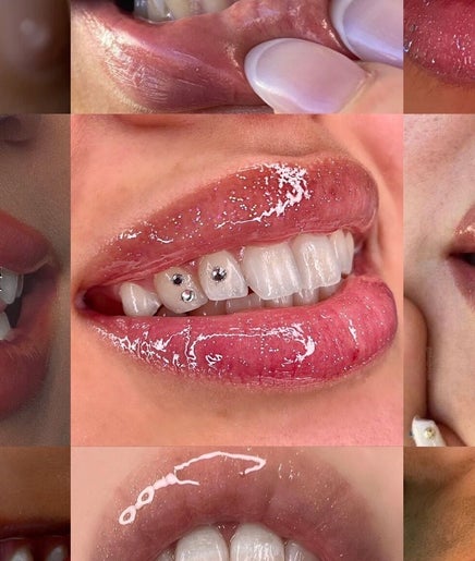 Aurora Tooth gems image 2