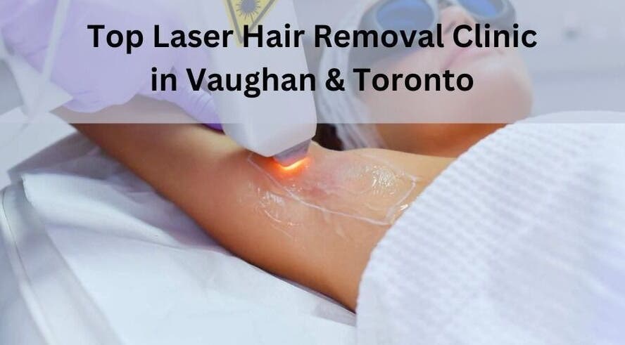 Laser hair removal session at MK Cosmetic Clinic in Vaughan, Ontario, CA.