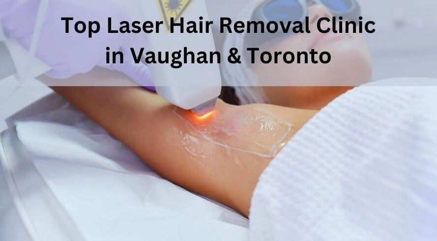 Laser hair removal session at MK Cosmetic Clinic in Vaughan, Ontario, CA.