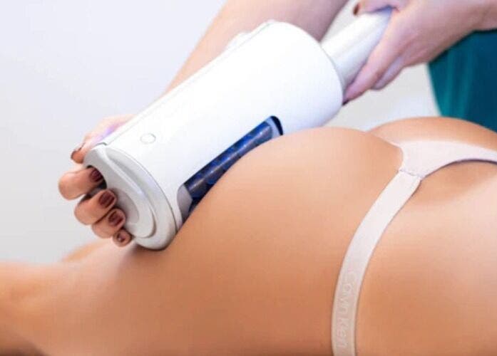 Body sculpting at MK Cosmetic Clinic, Vaughan, Ontario, CA for effective fat reduction.